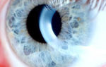 Реабилитация после операции катаракта глаза — послеоперационный период после замены хрусталика