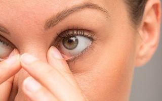 Птеригиум глаза — причины и описание лечения (фото)