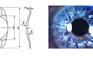 Операция при астигматизме на глаза — виды и стоимость (видео)