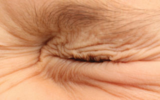 Блефароспазм глаза: причины и лечение (фото)