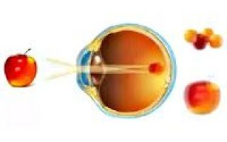 Миопический астигматизм глаз – причины, симптомы и лечение