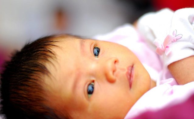 Желтые белки глаз у новорожденных (причины)