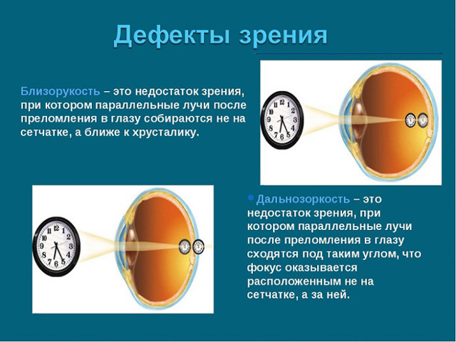 Глазные капли для улучшения зрения при дальнозоркости, витамины для глаз