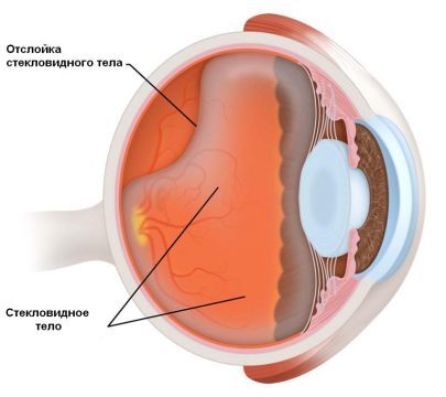 Вспышки в глазах (причины и лечение). Вспышки в темноте перед глазами