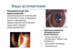 Как лечить астигматизм глаз в домашних условиях (видео)