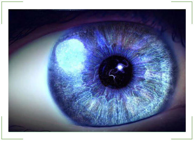 Вспышки в глазах (причины и лечение). Вспышки в темноте перед глазами