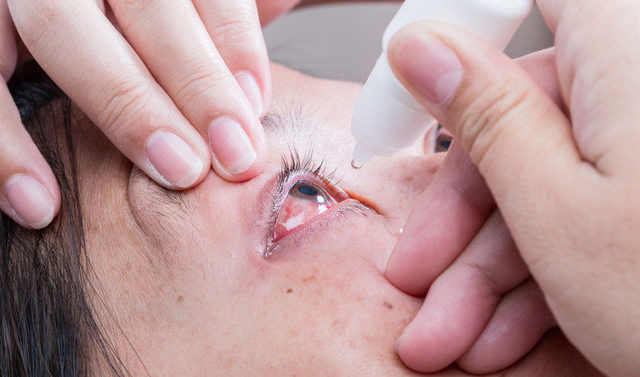 Глазные капли от катаракты — капли после операции и для лечения