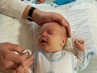 Как делать массаж при дакриоцистите новорожденных (видео)