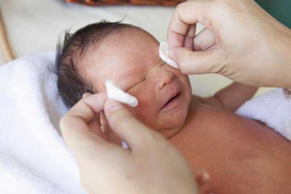 Конъюнктивит у новорожденного: симптомы и лечение конъюнктивита у грудничка