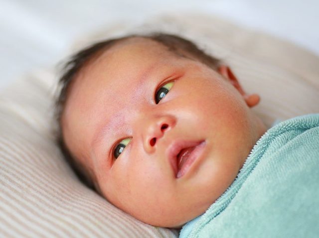 Желтые белки глаз у новорожденных (причины)