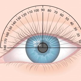 Астигматизм глаз — что это и как лечить, причины и симптомы заболевания