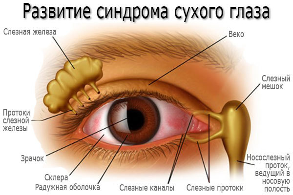 Ощущение инородного тела в глазу – причины и лечение