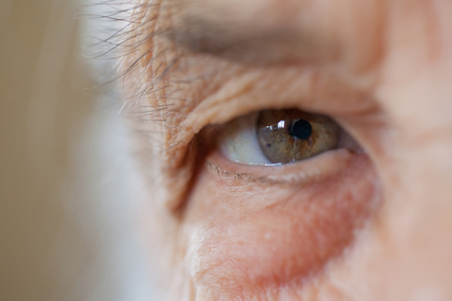 Лечится ли глаукома глаза, можно ли вылечить глаукому без операции