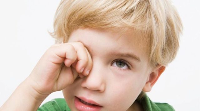 Блефарит у детей — причины, симптомы и лечение (фото)