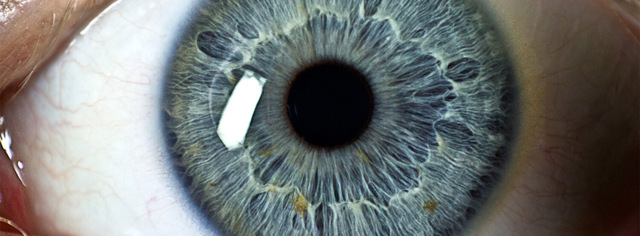 Дистрофия роговицы глаза: причины, симптомы и лечение
